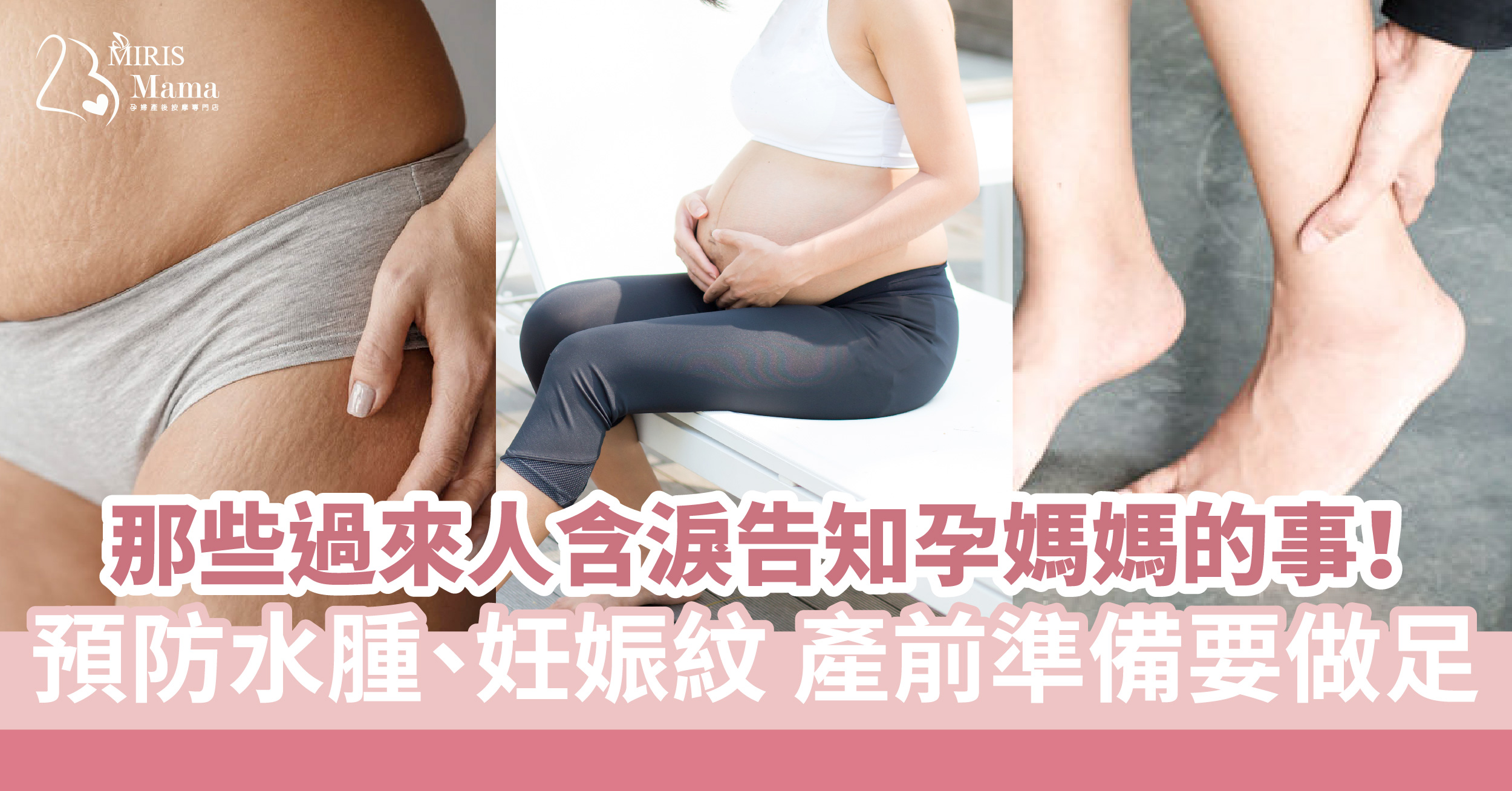 那些過來人含淚告知孕媽媽的事!預防水腫、妊娠紋產前準備要做足