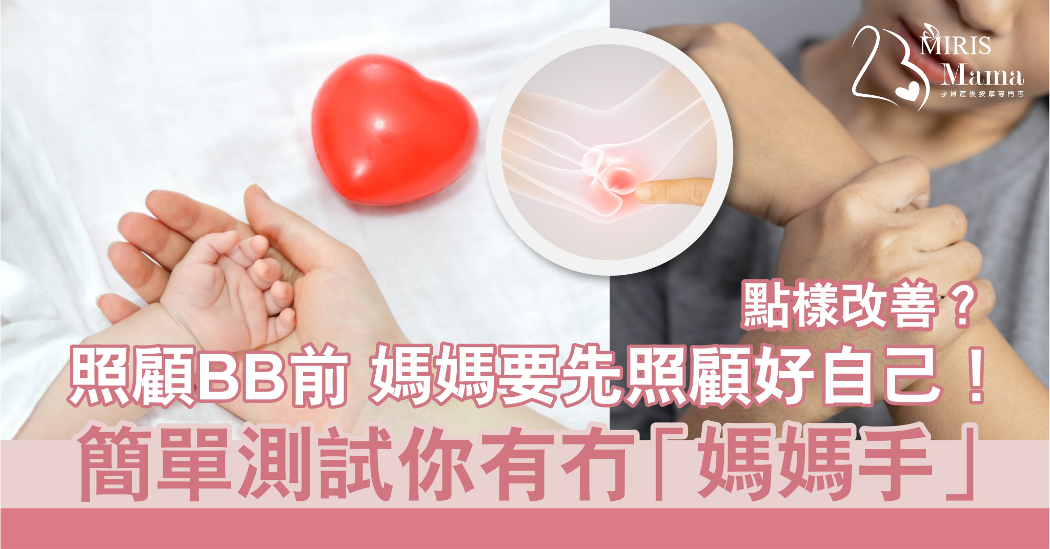 簡單測試你有冇「媽媽手」+改善方法