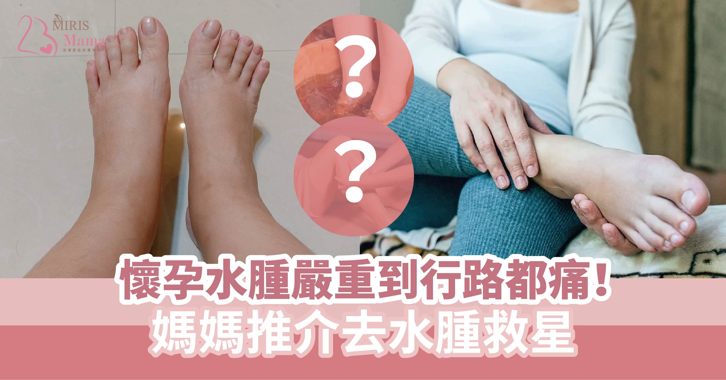 懷孕水腫嚴重到行路都痛!媽媽推介去水腫救星